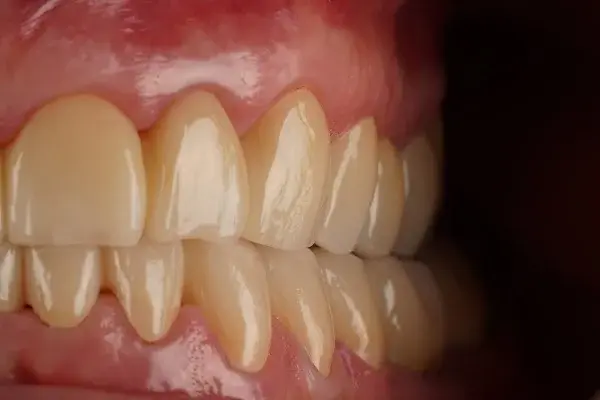 Dr. Andrea Diehl - zahnmedic